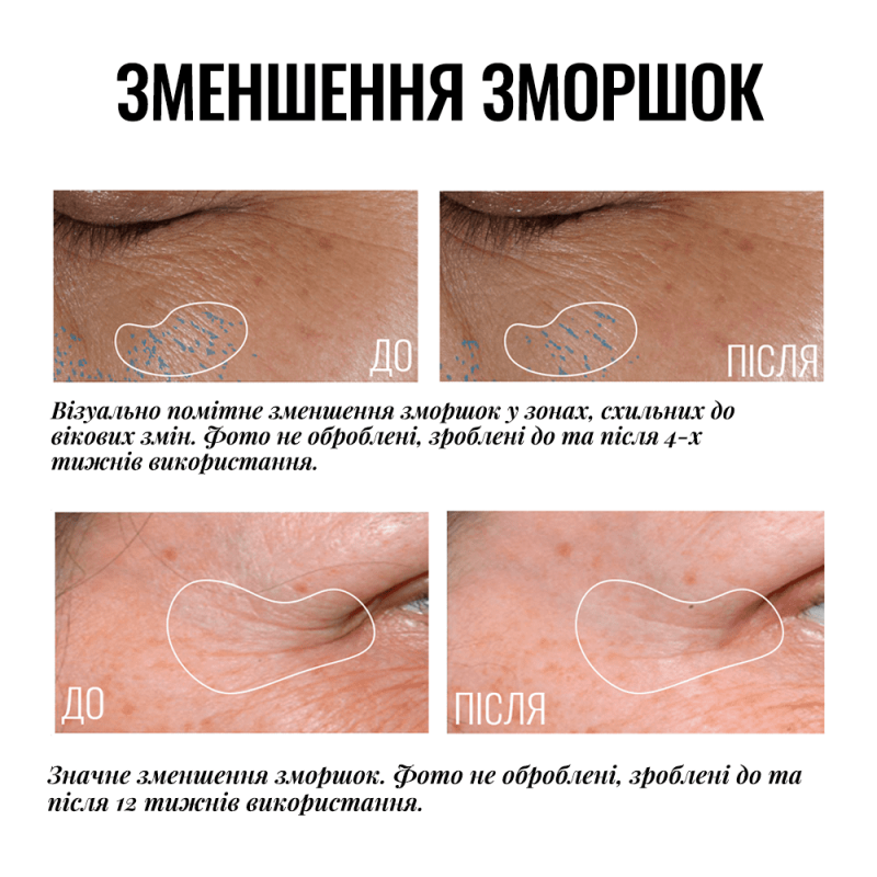 Крем-ліфтинг для повік з освітлювальним ефектом Instytutum Truly-Transforming Brightening Eye Cream 15 ml